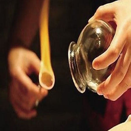 贵州专业玻璃拔罐